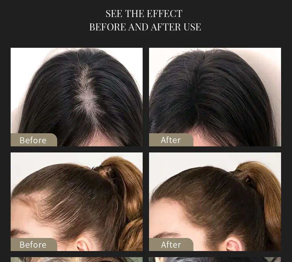 Fibras capilares + Dosificador Sevich 25g