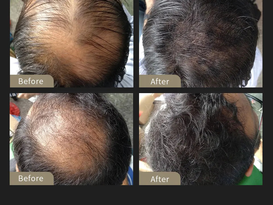 Fibras capilares + Dosificador Sevich 25g